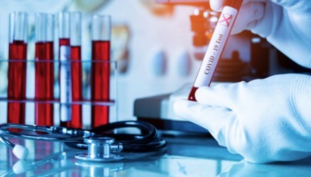 The Lancet entlässt eine Gruppe von Wissenschaftlern, die die Ursprünge von COVID-19 untersuchen
