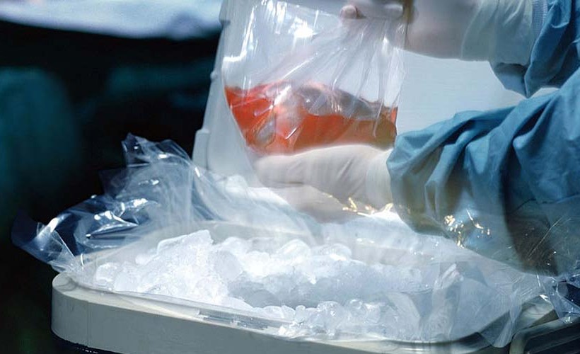 Une nouvelle technologie transforme le groupe sanguin d'un organe donneur en un groupe universel