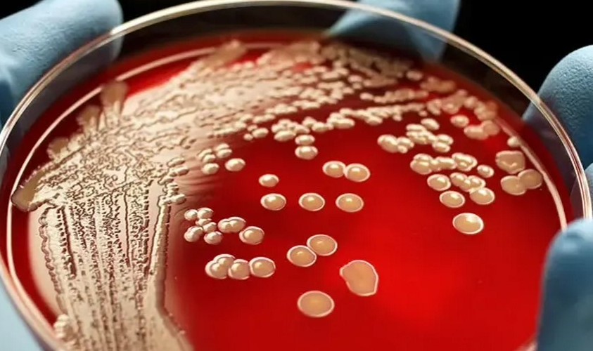 Criou um antibiótico que destrói todas as cepas de estafilococos resistentes