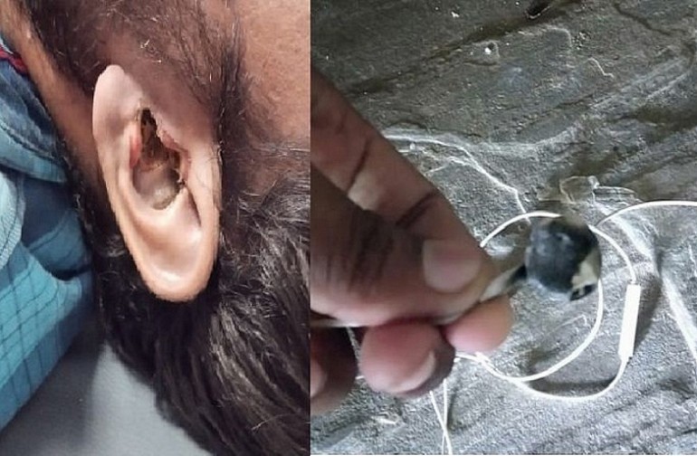 Un casque sans fil explosé a tué un homme