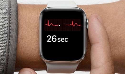 Apple Watch apprendra à mesurer la pression artérielle et la température corporelle