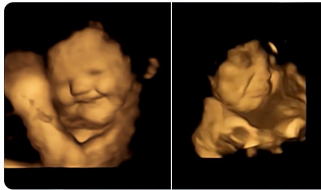 Os bebês no útero provam a comida que sua mãe come.