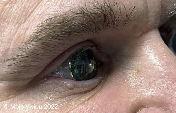 Mojo Vision desenvolve lentes de contato de realidade aumentada