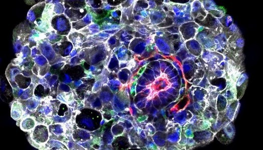 Wissenschaftler haben herausgefunden, wie sich der menschliche Embryo in der zweiten Lebenswoche entwickelt